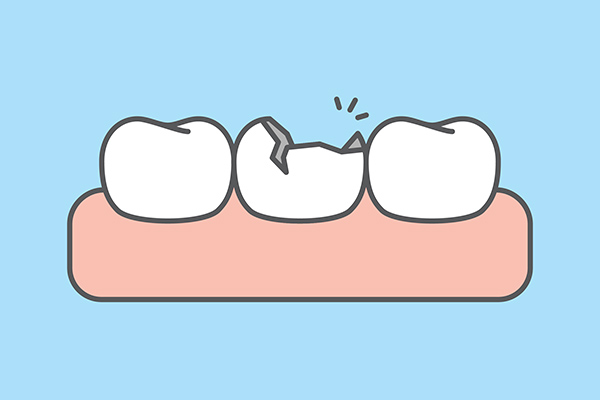 General Dentistry Options For Treating An Injured Tooth